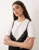 Short Sleeve Lace Overlay Mini Dress In White And Black
